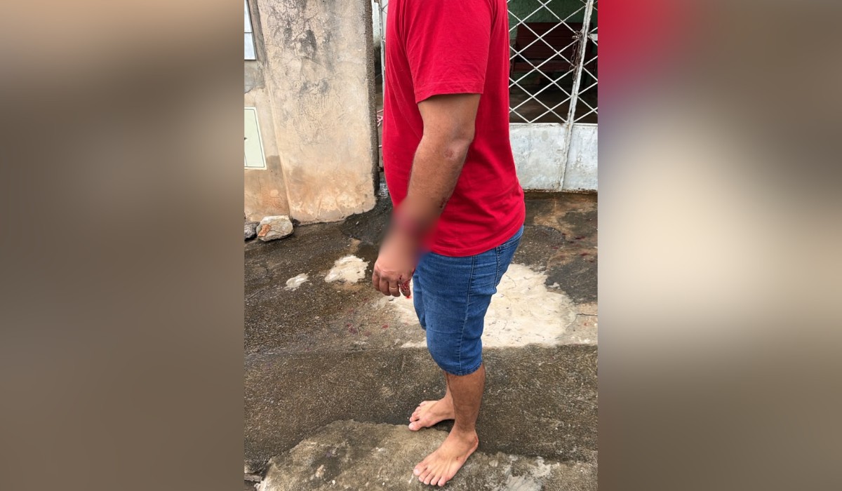 Ataque de dois pitbulls fere duas irmãs em Álvares Machado; um dos cães é morto pela PM